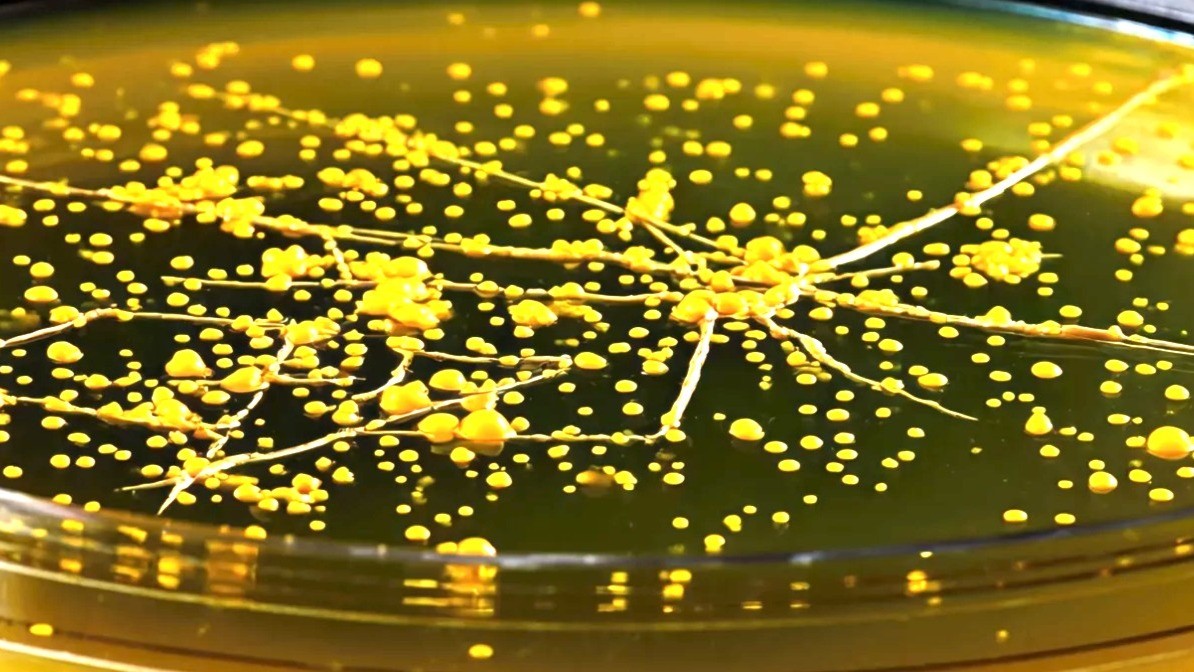 Inflammation, Residual Risk, & Our Largest Immune Organ