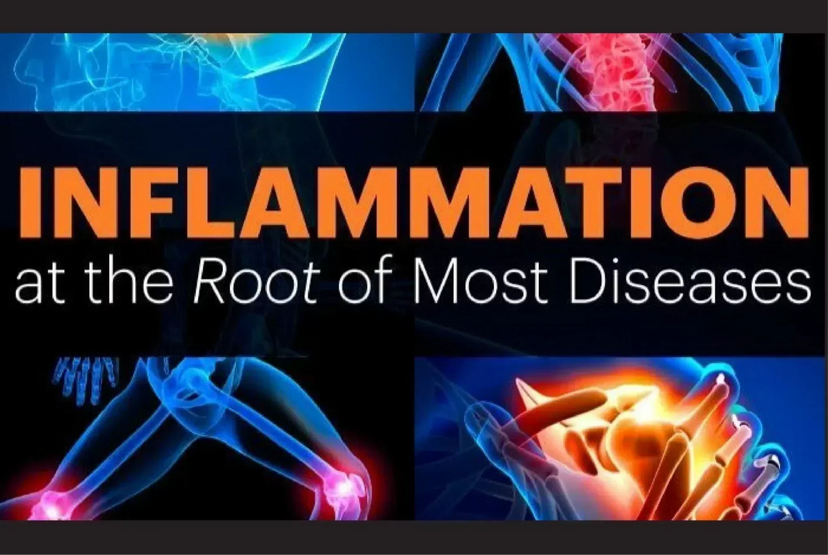 Gut Microbiome Part 1: Inflammation